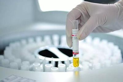 中國IVD試劑臨床使用現(xiàn)狀與挑戰(zhàn) 基于診斷技術(shù)研發(fā)視角的分析